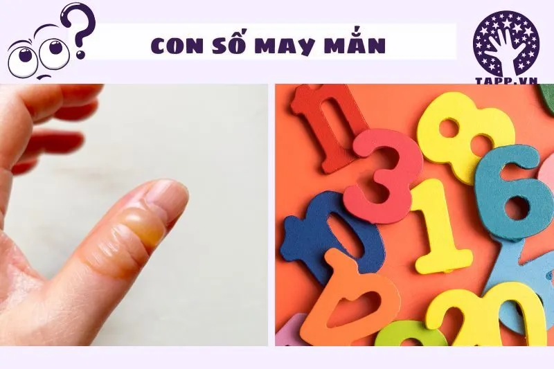 Con số may mắn liên quan đến giấc mơ bị bỏng