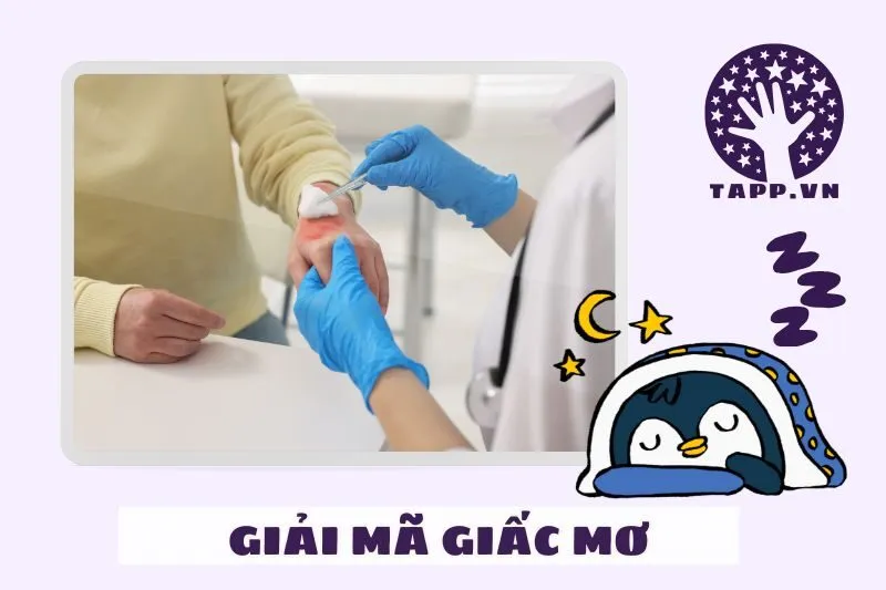 Điềm báo từ giấc mơ bị bỏng: Lành hay dữ?