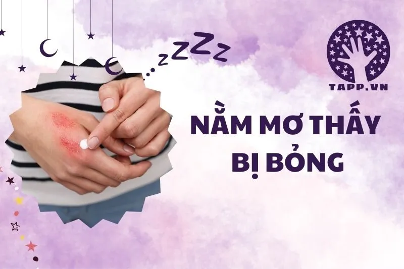 Giải mã giấc mơ: Nằm mơ thấy bị bỏng, điềm lành hay dữ 2025?