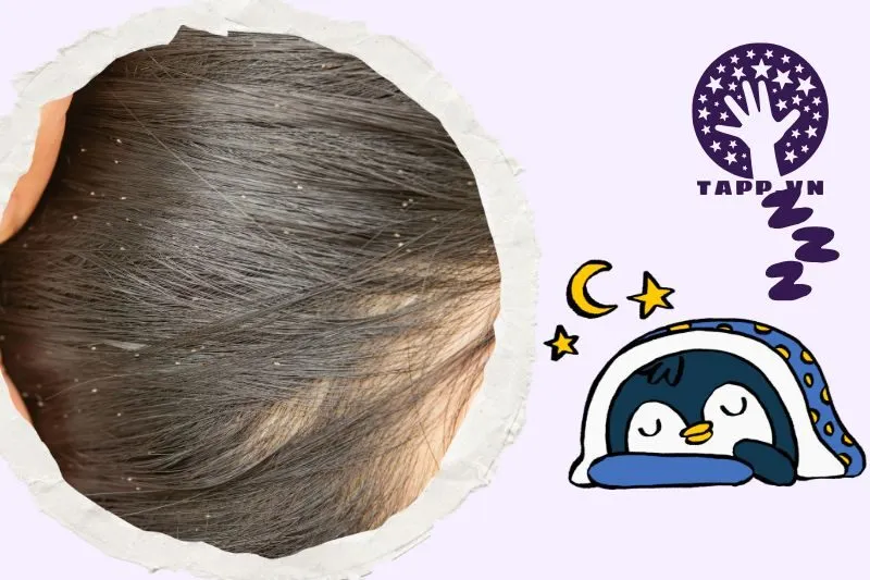 Nằm mơ thấy con chấy có ý nghĩa gì?