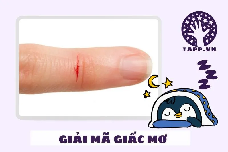 Giải mã các hình ảnh phổ biến trong giấc mơ thấy đứt tay