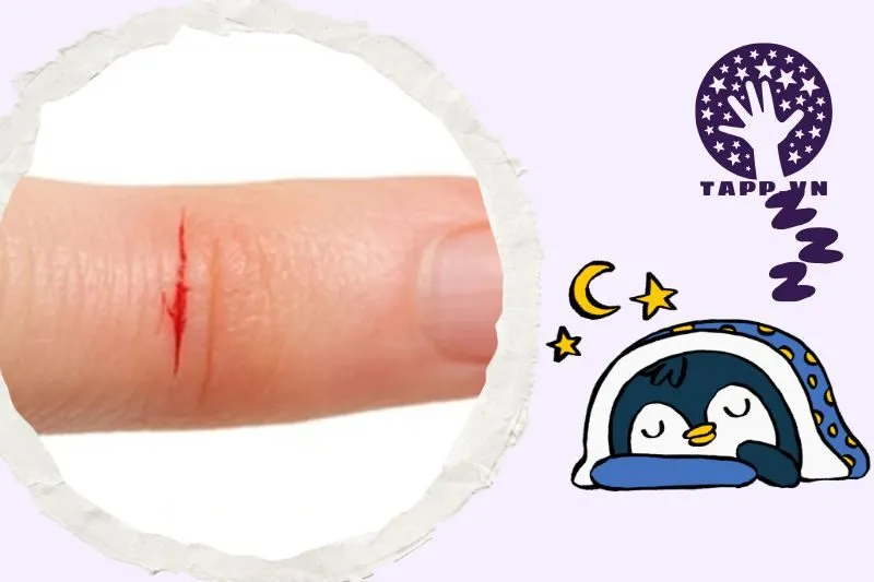 Nằm mơ thấy đứt tay: Ý nghĩa và điềm báo